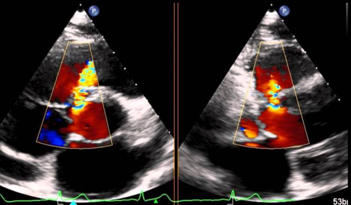 Ultrasonido Doppler Color Guanajuato